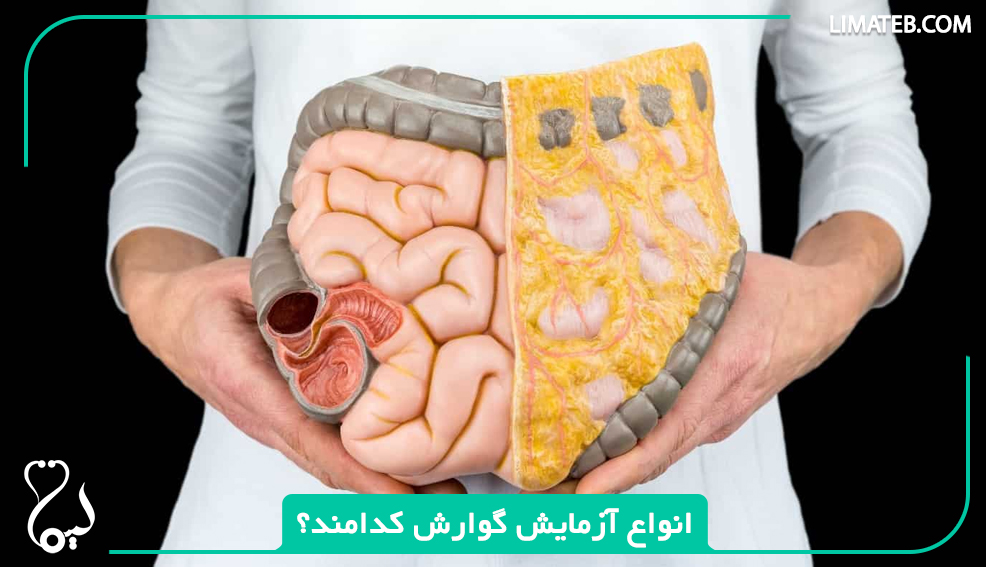 انواع آزمایش گوارش کدامند؟