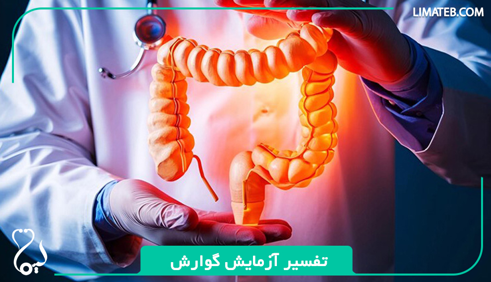 تفسیر آزمایش گوارش