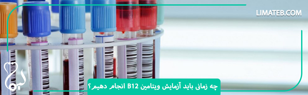 چه زمانی باید آزمایش ویتامین B12 انجام دهیم؟